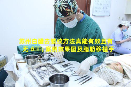 苏州白醋去皱纹方法真能有效且有无 🐡 案例效果图及脂肪移植手术相关图片展示吗
